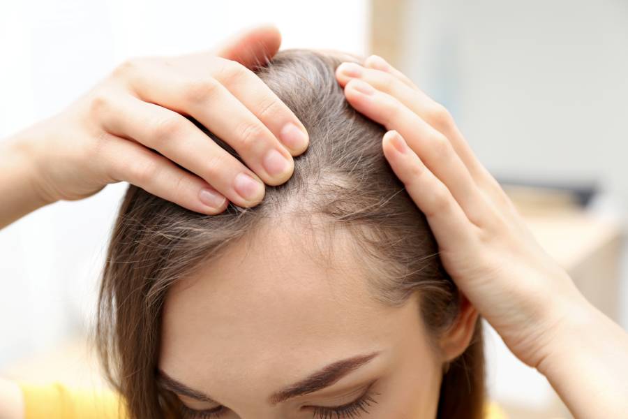 Close up of young woman with hair loss problem