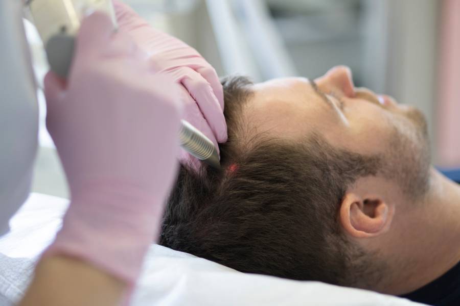 Treatment to stimulate hair growth to a patient man.