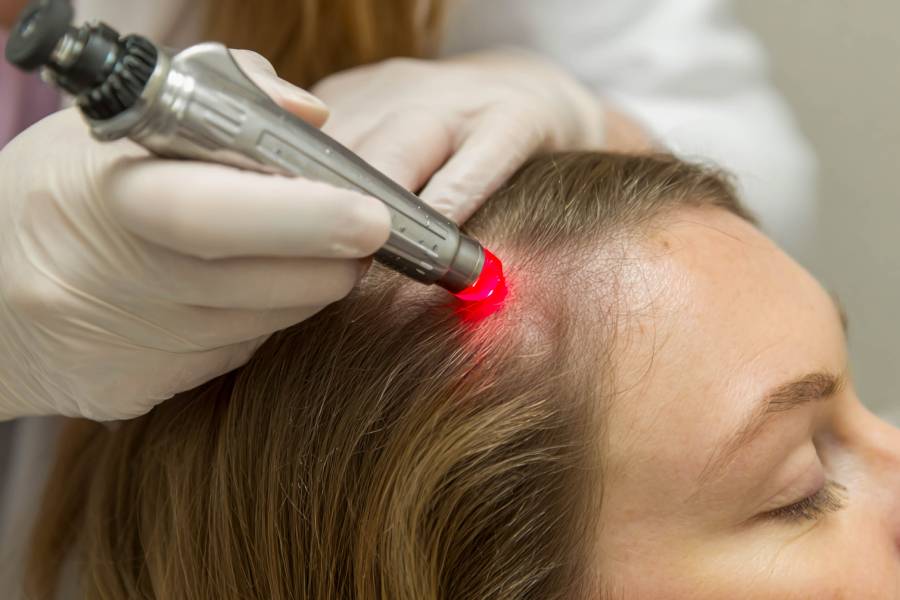 Laser scalp therapy on a woman at the clinic. A modern treatment for hair loss and growth stimulation using a red laser